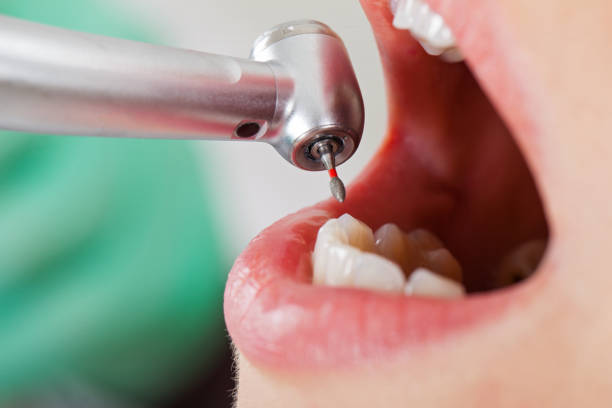 Best Broken Tooth Emergency  in Valparaiso, FL